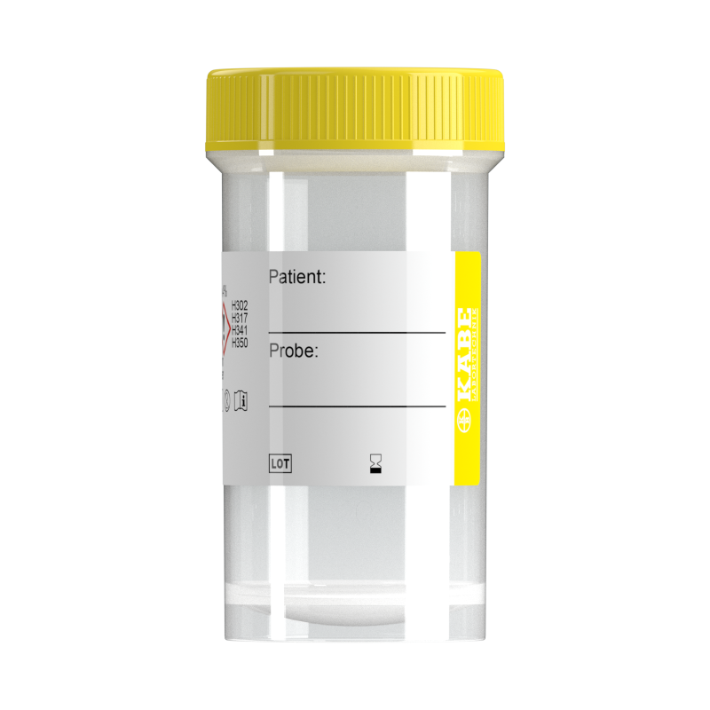 Probengefäße 50 ml mit Formalin