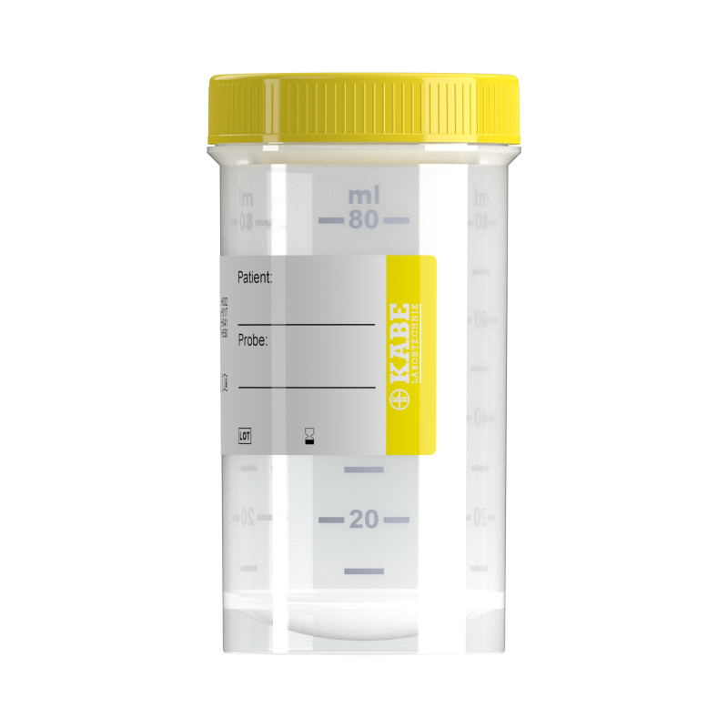 Probengefäße 100 ml mit Formalin
