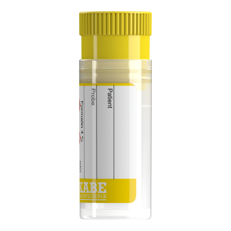 Probenröhren 5 ml mit Formalin